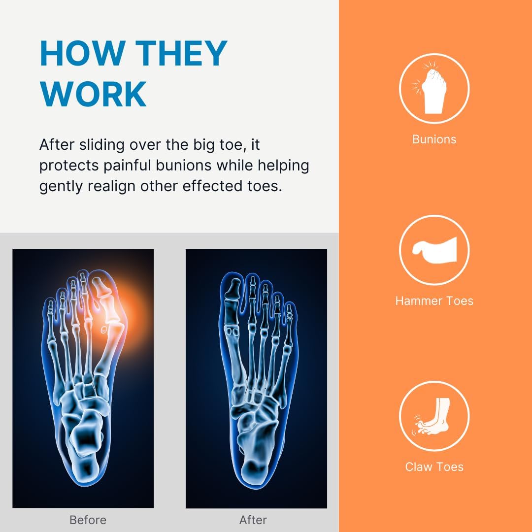 Gel Bunion Guard Spacer for Toe with Bunions.