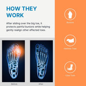 Gel Bunion Guard Spacer for Toe with Bunions.