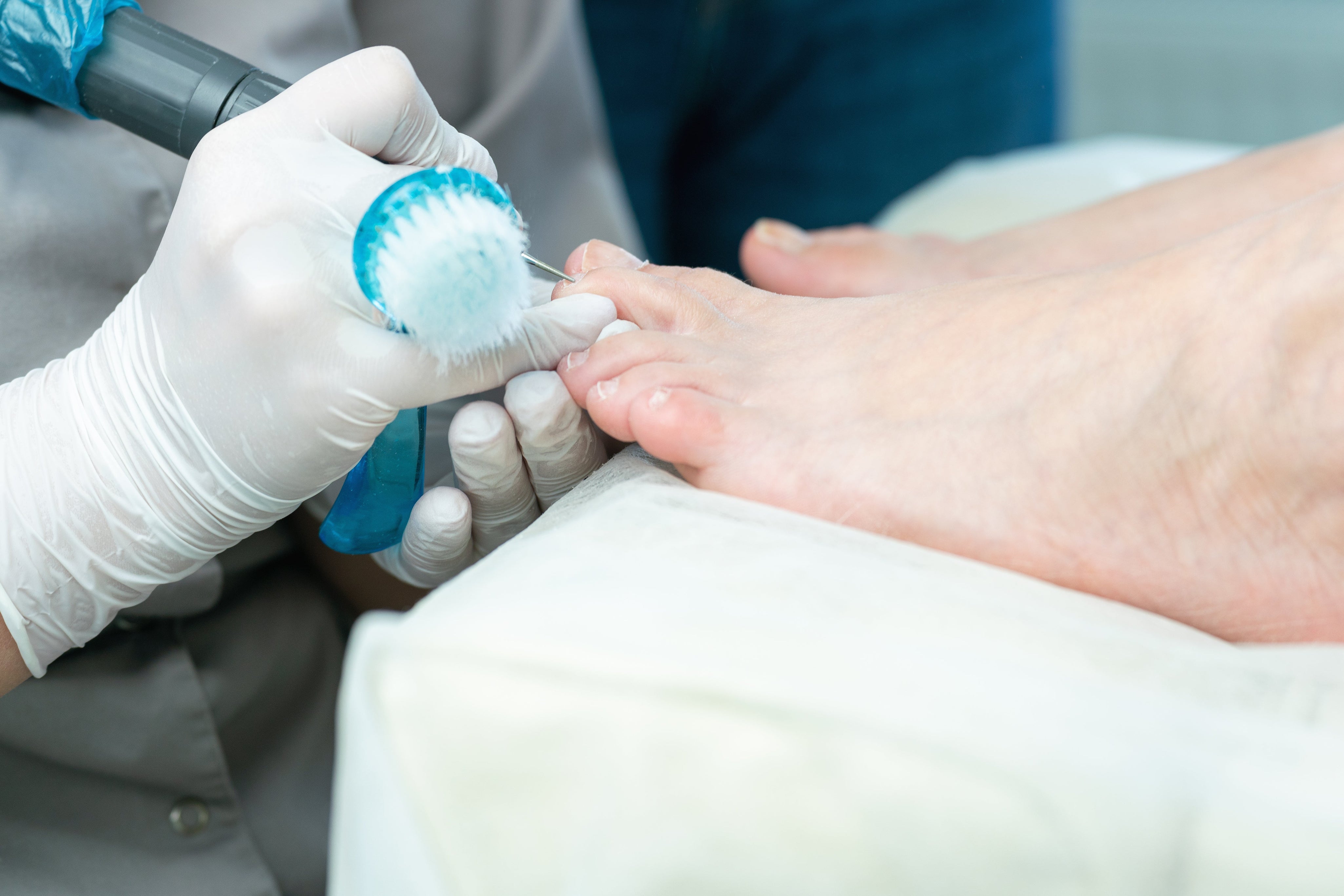 Podiatrist treating a patient’s thick toenails during a foot exam, demonstrating safe medical toenail care and fungal infection treatment.