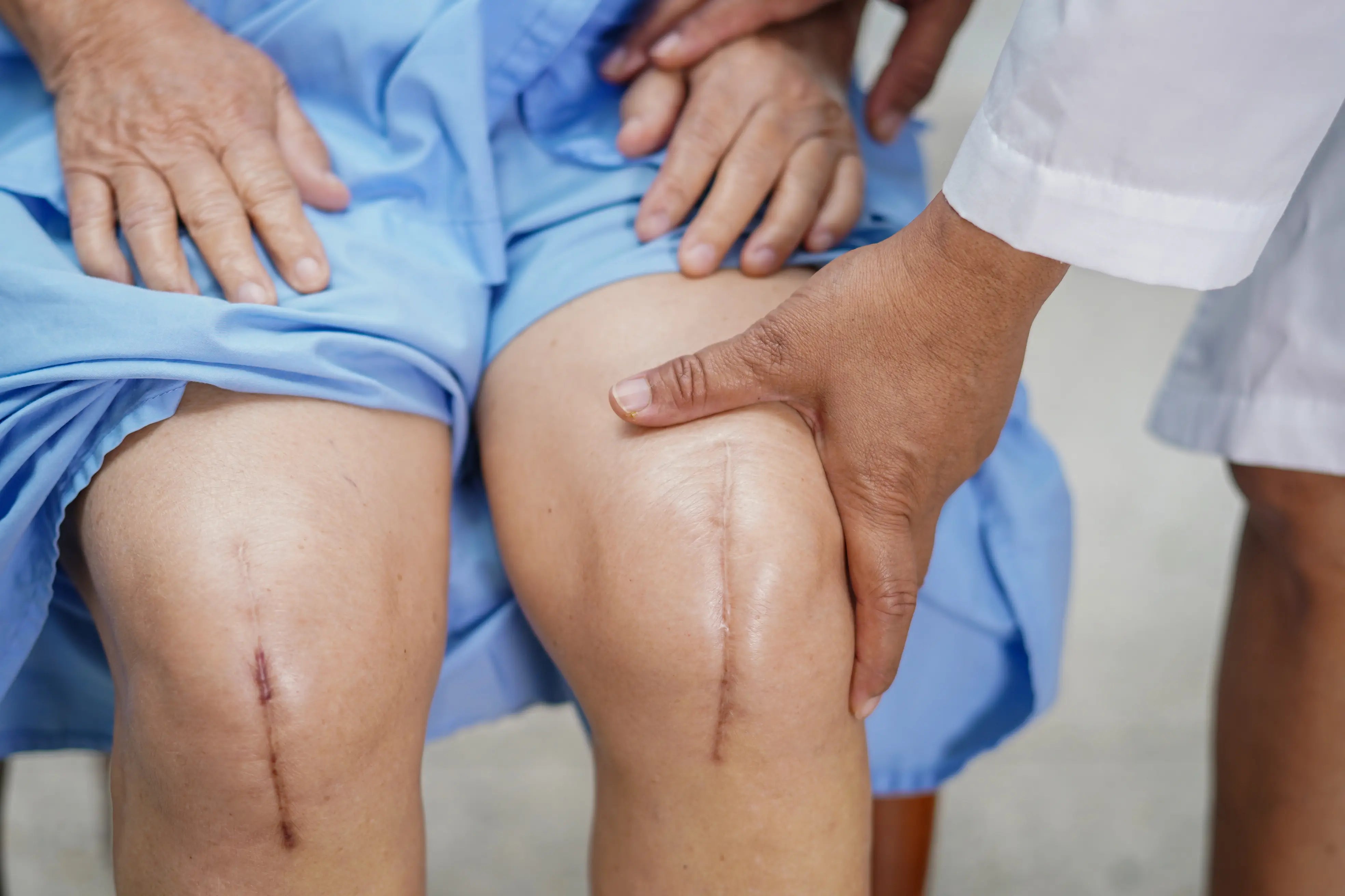 Knee Replacement Recovery: Cold Therapy Week by Week
