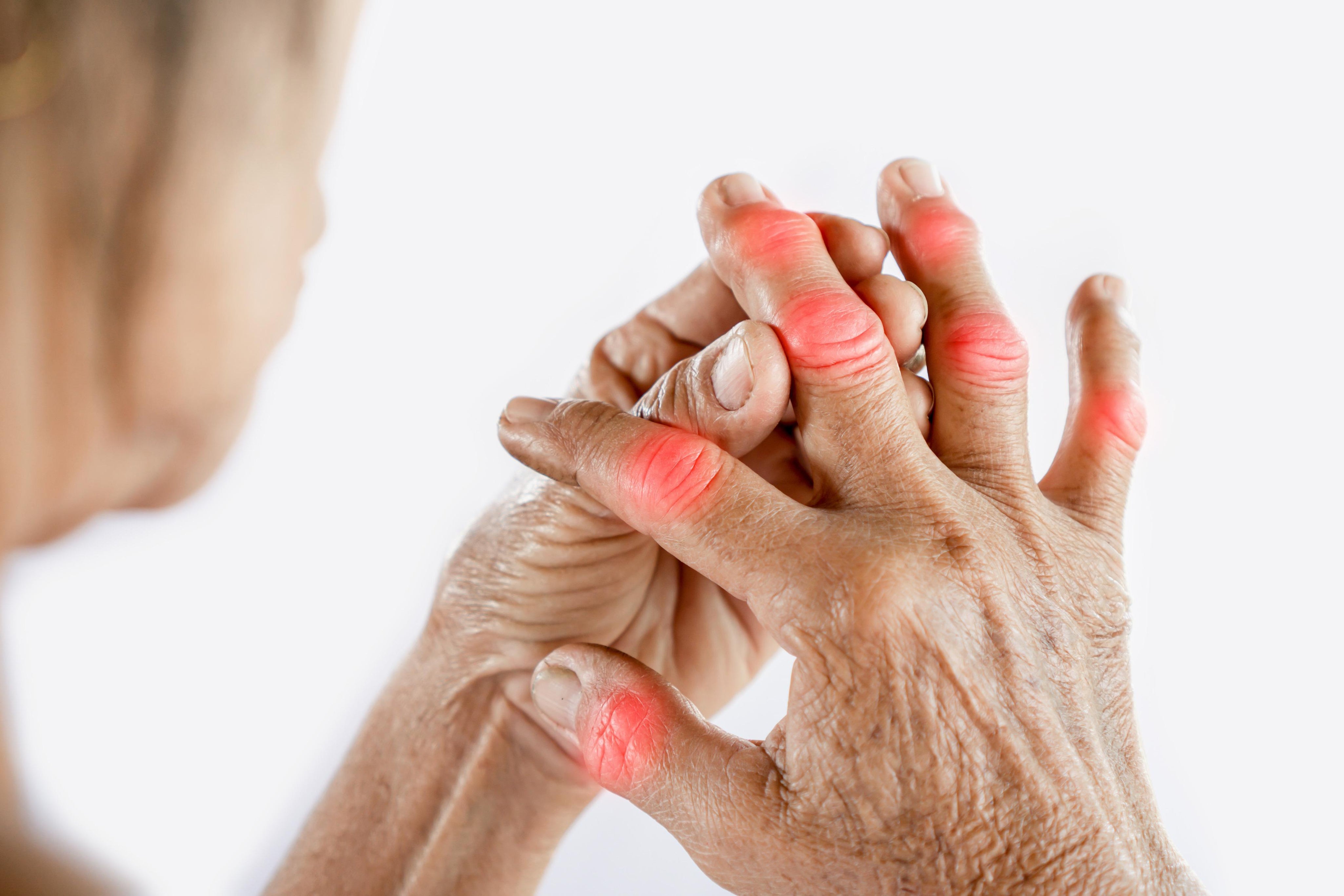 Older person with painful finger joints