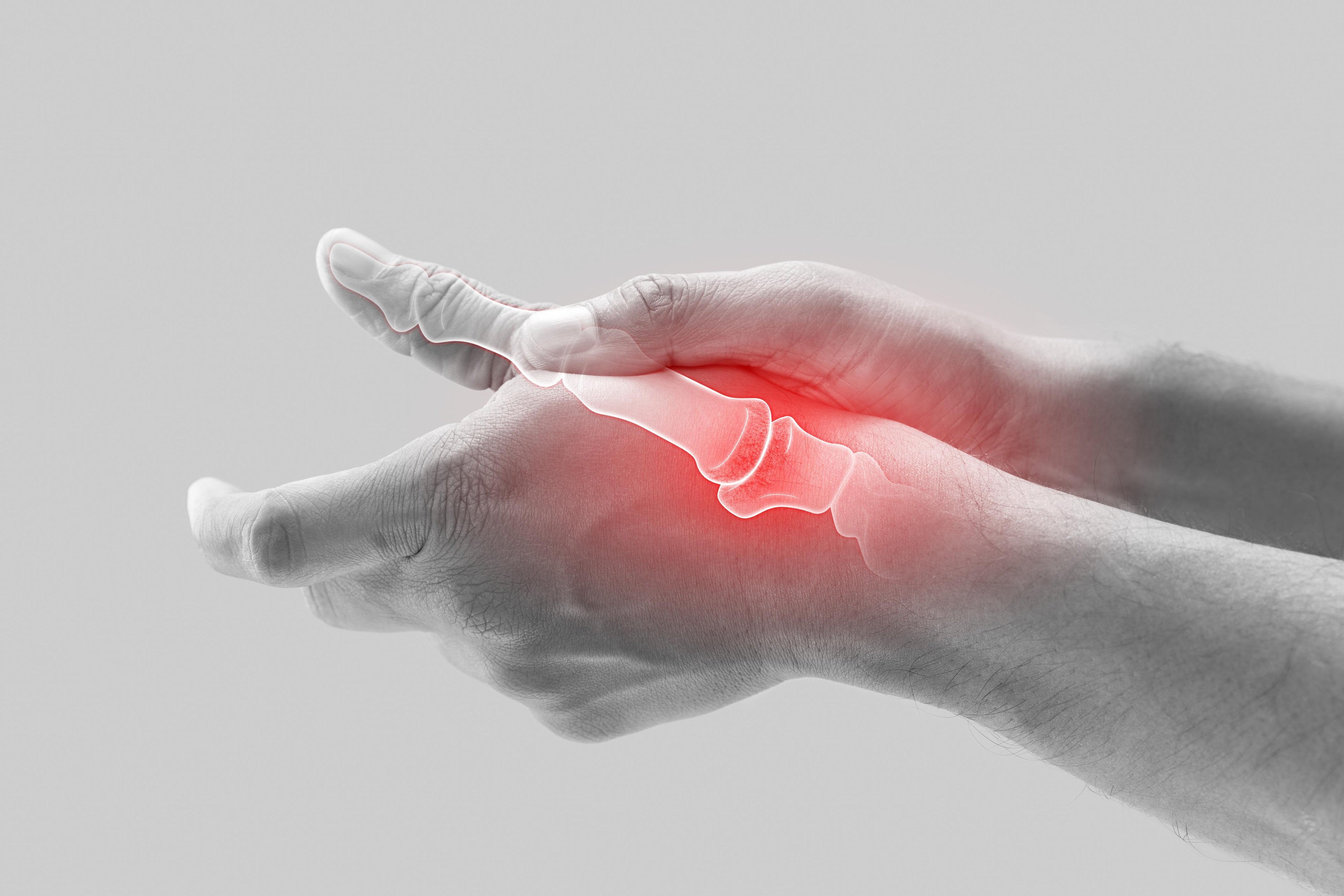 Jammed Thumb: Signs, Treatment, and Recovery