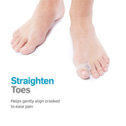 Person wearing toe spreader showing how it can gently align crooked toes to ease pain